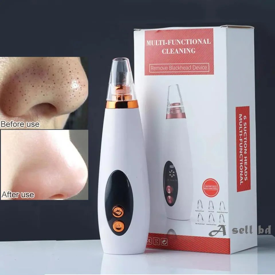 Black Head Remover
